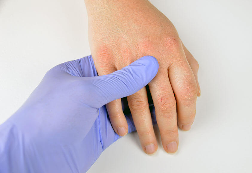 Nitrile disposable gloves are practical helpers in every medical practice Nitrile gloves in medical examination