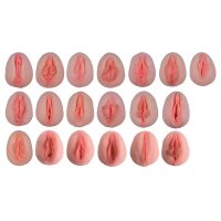 Erler Zimmer Model - Vulva-Casts Showing Anatomical...