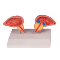anatomical model of prostate by Erler Zimmer, 2-piece,...