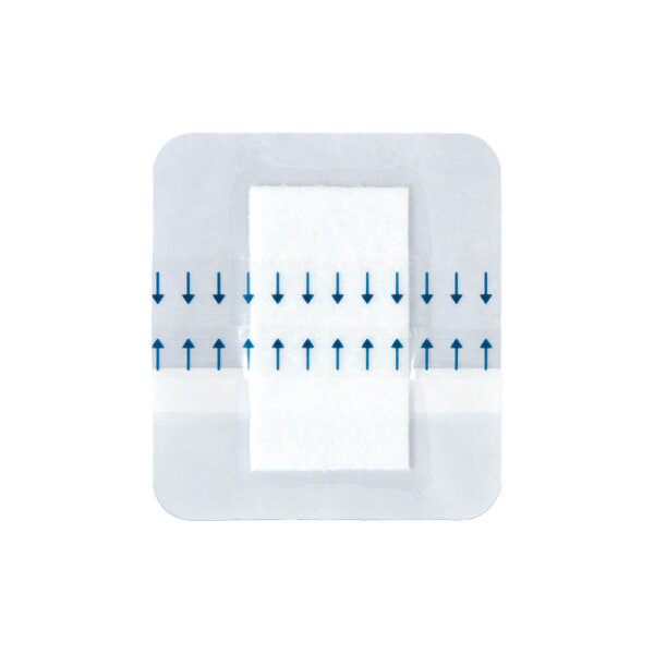 Noba Rudafilm island plaster, transparent foil, sterile, 50 pieces, various sizes. Sizes