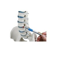 Erler Zimmer spine with disc herniation and removable pelvis