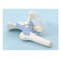 Erler Zimmer Hip joint + ligaments model, mobile, with /...
