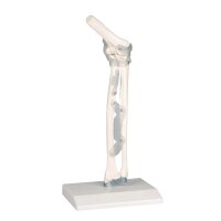 Erler Zimmer model Elbow joint with ligaments, with /...
