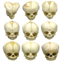 Erler Zimmer fetus skull anatomy model, different....