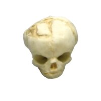 Erler Zimmer fetus skull anatomy model, different. Development Weeks