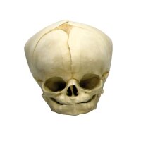 Erler Zimmer fetus skull anatomy model, different. Development Weeks