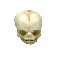 Erler Zimmer fetus skull anatomy model, different. Development Weeks