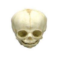 Erler Zimmer fetus skull anatomy model, different. Development Weeks