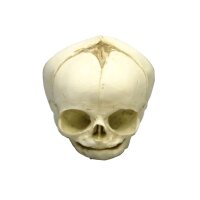 Erler Zimmer fetus skull anatomy model, different. Development Weeks