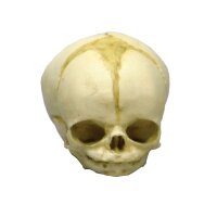 Erler Zimmer fetus skull anatomy model, different. Development Weeks