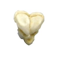 Erler Zimmer fetus skull anatomy model, different. Development Weeks