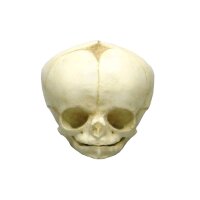 Erler Zimmer fetus skull anatomy model, different. Development Weeks