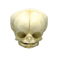 Erler Zimmer fetus skull anatomy model, different. Development Weeks