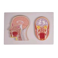 Erler Zimmer relief model, frontal and midline incision...