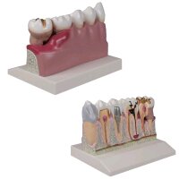 Dental model by Erler Zimmer, lower jaw with teeth 3 -7,...