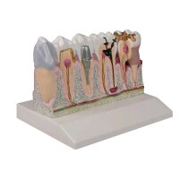 Dental model by Erler Zimmer, lower jaw with teeth 3 -7,...
