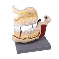 Upper and lower jaw model Erler Zimmer, numbered,...