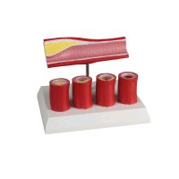 Erler Zimmer artery model, 4 sections, constrictions...