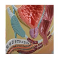 Erler Zimmer Pelvis Section Model, prostate diseases, 1/2...
