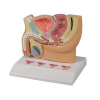 Erler Zimmer Pelvis Section Model, prostate diseases, 1/2...