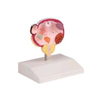 Erler Zimmer bladder and prostate model, 5 pathologies...