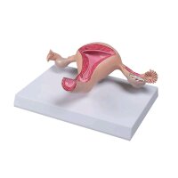Erler Zimmer uterus model, life-size, painted, teacher...