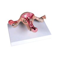 Erler Zimmer uterus model with diseases, life-size,...