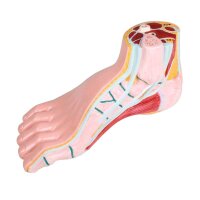 Erler Zimmer pes cavus model, open media, life-size,...