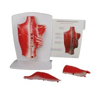 Back muscles model Erler Zimmer, 4 pieces, incl. 2...