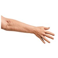 Geriatric IV Training arm of Erler Zimmer, injection arm...