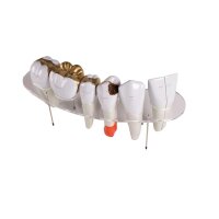 Dental model by Erler Zimmer, lower jaw with teeth 3 -7,...