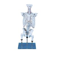 Spine model for the demonstration of malpositions...
