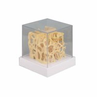 Erler Zimmer Comparision Model - Healthy/Osteoporotic...