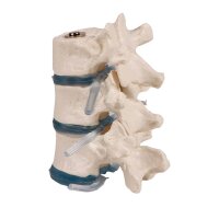 Erler Zimmer Three Thoraric Vertebrae with intervertebral...
