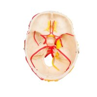 Erler Zimmer Model, Neurovascular Skull with Brain