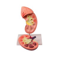 Erler Zimmer Model - Kidney w. Adrenal Gland, 2 Times...