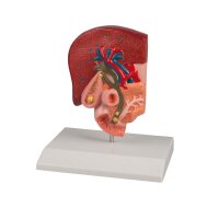 Erler Zimmer Desktop Model - Gallstone, Half Size