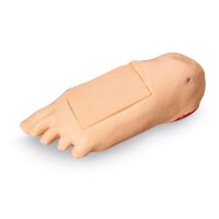 Erler Zimmer Edema Foot with Deep Tissue Injury for...