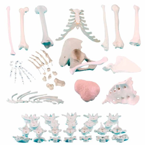 Erler Zimmer Bone Model, Different Variants
