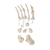Erler Zimmer Bone Model, Different Variants