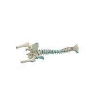 Erler Zimmer Standard Spine w. Prolapse and Pelvis, Diff. Variants
