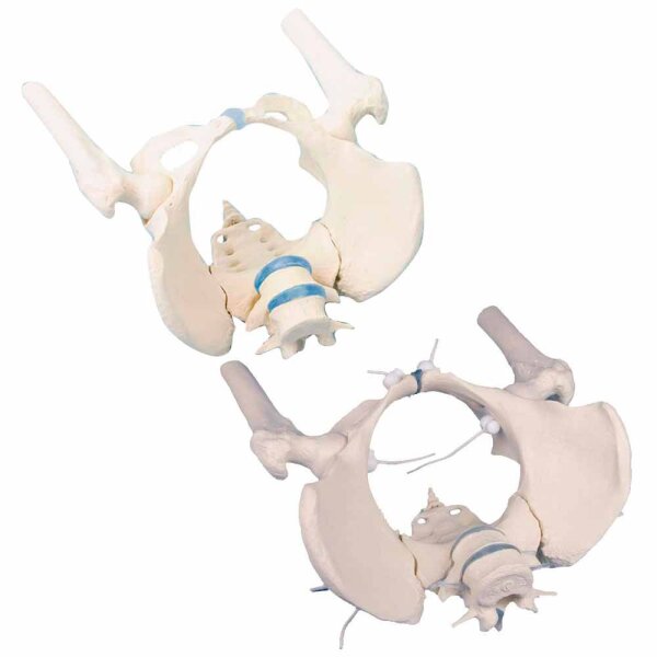Erler Zimmer Female Pelvis/Sacrum/Lumb. Vertebrae/Stumps Diff. Var.