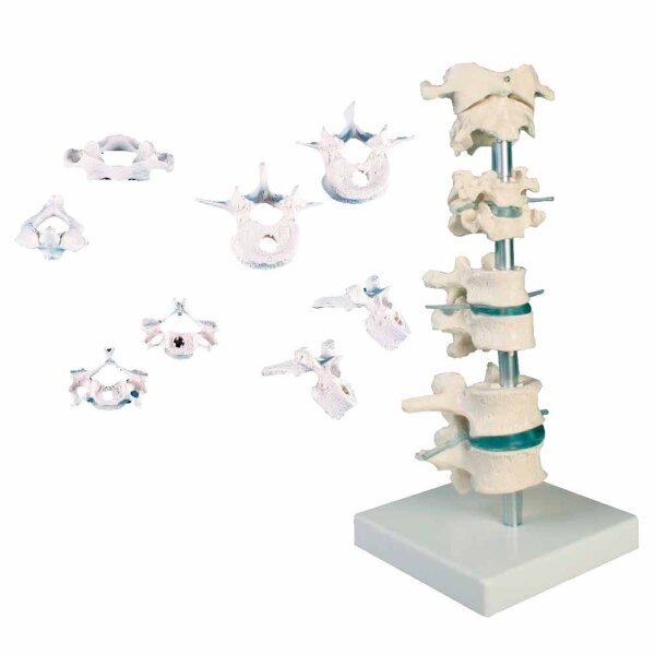 Erler Zimmer Model - 8 Vertebrae, Different Variants
