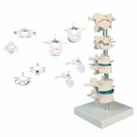 Erler Zimmer Model - 8 Vertebrae, Different Variants
