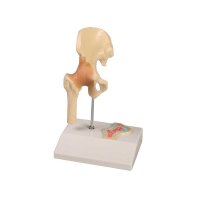 Erler Zimmer Miniature Joint with Cross Section/ Diff. Variants