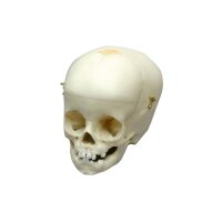 Erler Zimmer Child Skull, Different Sizes and Ages