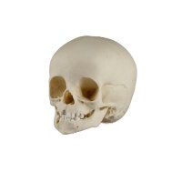 Erler Zimmer Child Skull, Different Sizes and Ages