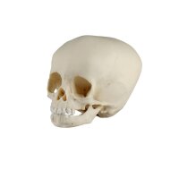 Erler Zimmer Child Skull, Different Sizes and Ages