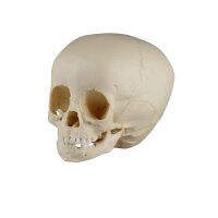 Erler Zimmer Child Skull, Different Sizes and Ages