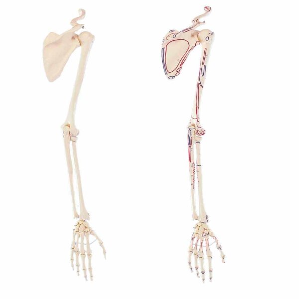 Erler Zimmer Skelton of Arm with Shoulder Girdle, Different Variants